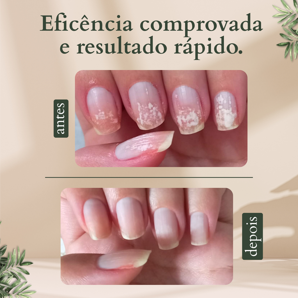 FloriumUnha conta-gotas 30ml