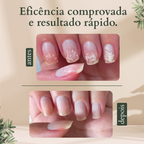 FloriumUnha conta-gotas 30ml