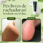 FloriumUnha e Hidratante para os pés