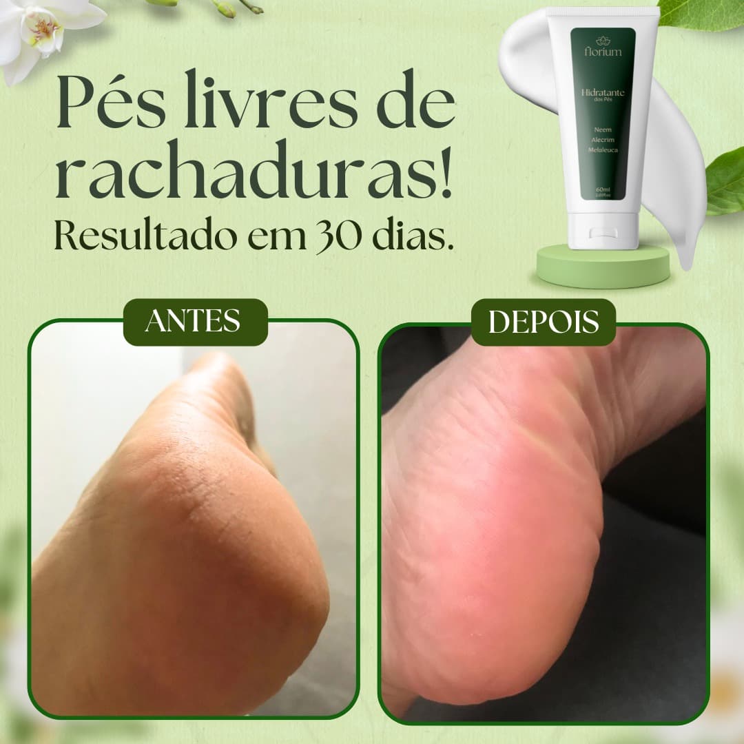 FloriumUnha e Hidratante para os pés